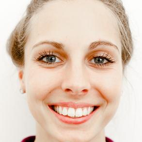Strahlende Zähne nach Zahnaufhellung (Bleaching) bei Zahnarzt Dr. Heiko Ehlers